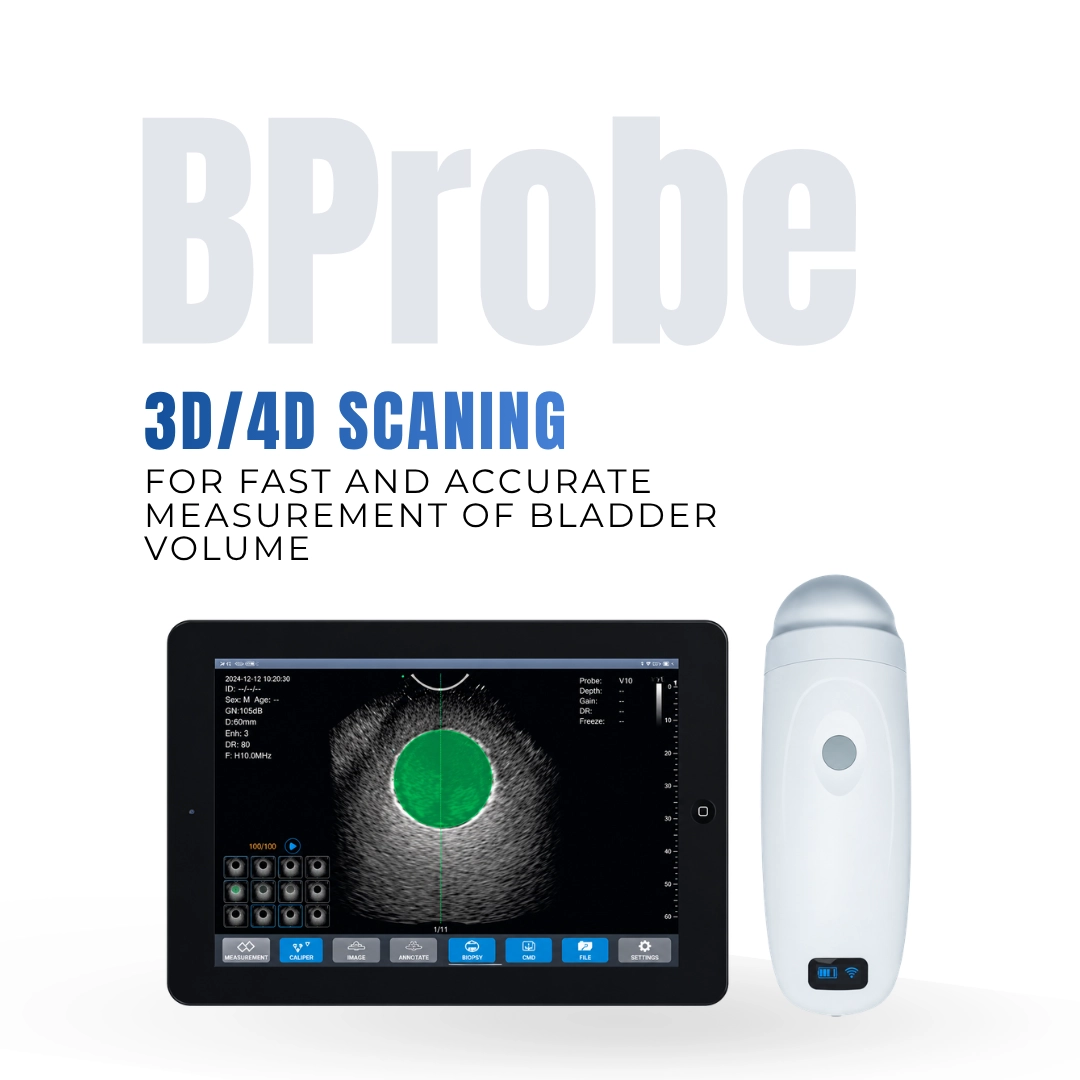 Brightfield Healthcare Bprobe wireless 3D/4D ultrasound probe for bladder volume measurement