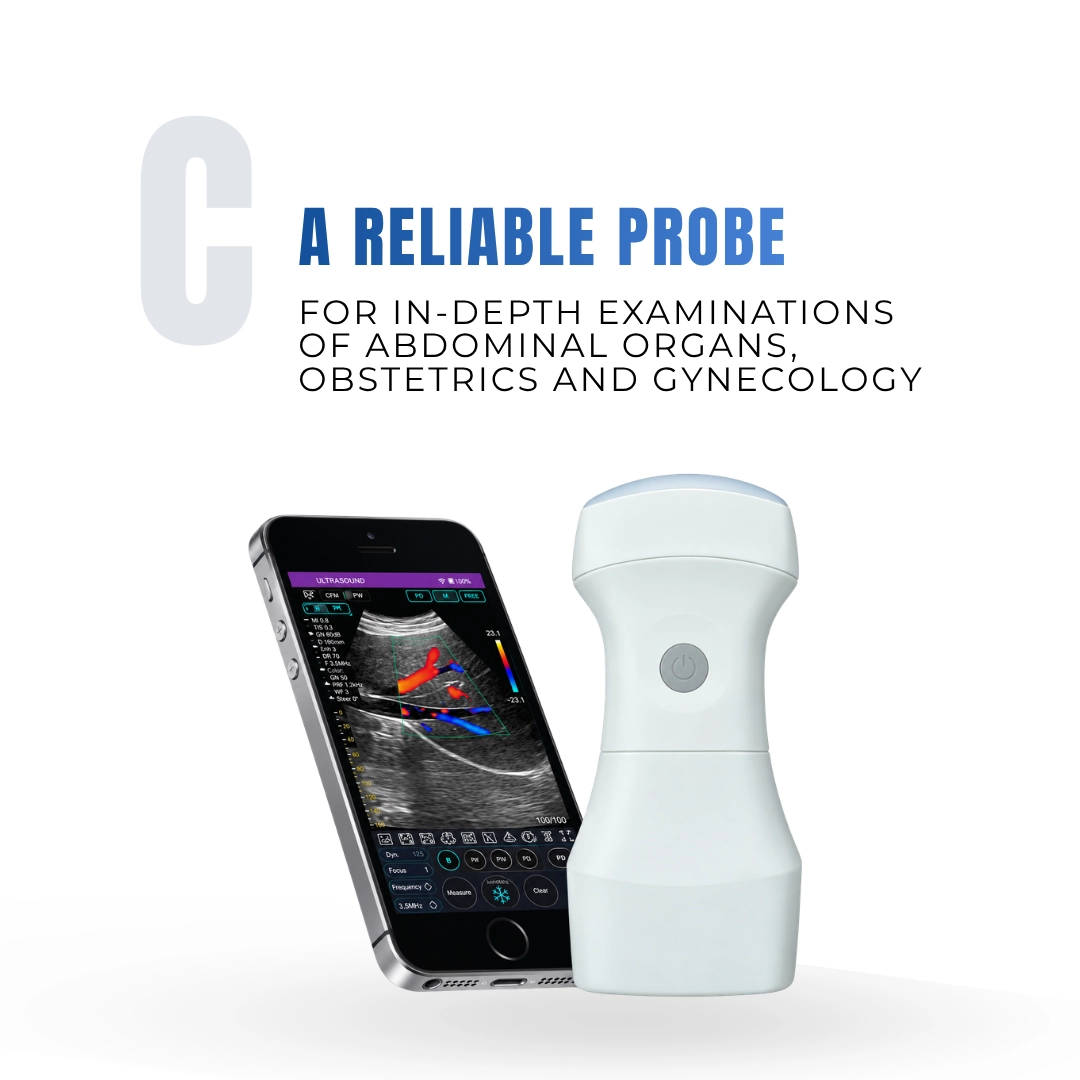 Brightfield Healthcare C wireless ultrasound probe for in-depth abdominal, obstetric and gynecological examinations