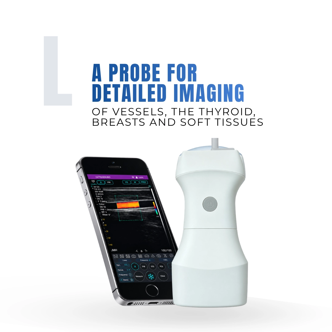 Brightfield Healthcare L wireless ultrasound probe for detailed imaging of vessels, thyroid, breasts and soft tissues